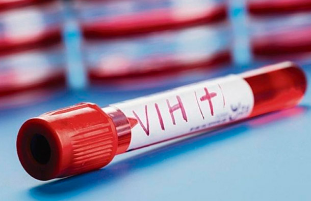 Se confirma segundo caso curado del VIH en el mundo